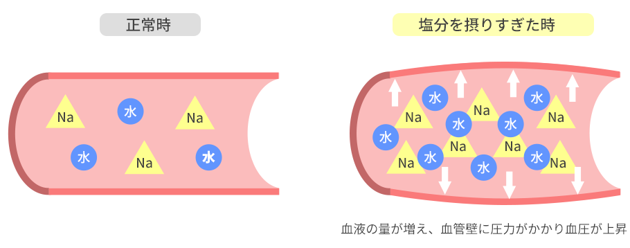 食塩は高血圧の関係